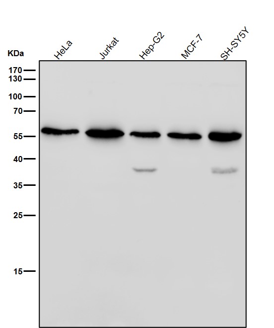 All lanes use the Antibody at 1:1K dilution for 1 hour at room temperature