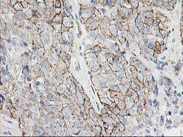m06153 anti apc2 anapc2 mouse monoclonal antibody clone id oti1a6 ihc testing 7