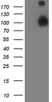HEK293T cells were transfected with the pCMV6-ENTRY control (Left lane) or pCMV6-ENTRY ANAPC2 (Right lane) cDNA for 48 hrs and lysed