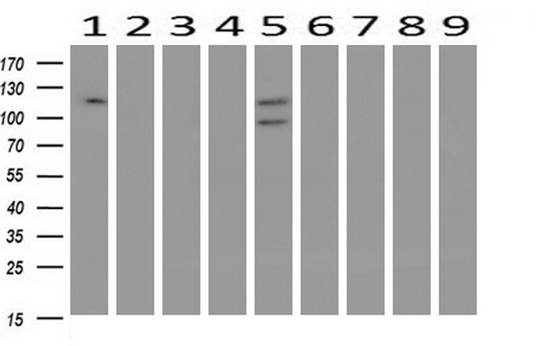 Western blot analysis of extracts (10ug) from 9 Human tissue by using anti-ANAPC2 monoclonal antibody at 1:200 (1: Testis; 2: Omentum; 3: Uterus; 4: Breast; 5: Brain; 6: Liver; 7: Ovary; 8: Thyroid gland; 9: colon)