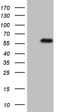 HEK293T cells were transfected with the pCMV6-ENTRY control (Left lane) or pCMV6-ENTRY TNFRSF19 (Right lane) cDNA for 48 hrs and lysed