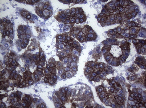 m06159 anti sync mouse monoclonal antibody clone id oti5b8 ihc testing 10