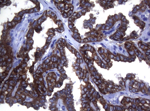 m06159 anti sync mouse monoclonal antibody clone id oti5b8 ihc testing 3