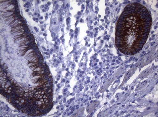 m06159 anti sync mouse monoclonal antibody clone id oti5b8 ihc testing 7