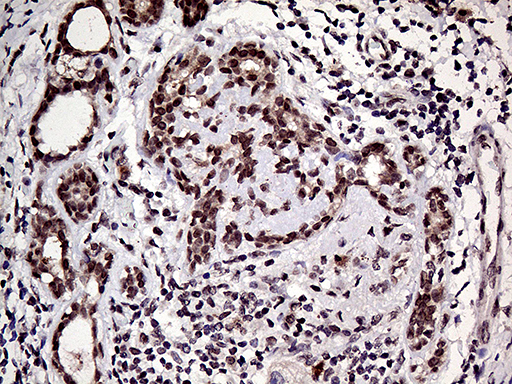 m06166 anti hoxd9 mouse monoclonal antibody clone id oti1h3 ihc testing 2