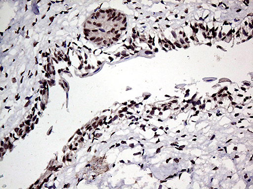 m06166 anti hoxd9 mouse monoclonal antibody clone id oti1h3 ihc testing 3