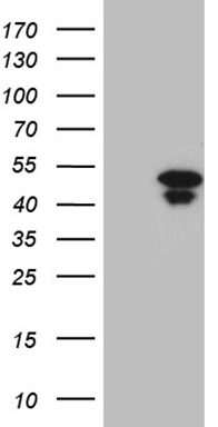 m06166 anti hoxd9 mouse monoclonal antibody clone id oti1h3 wb testing 1