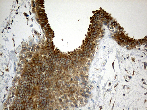 Immunohistochemical staining of paraffin-embedded Human breast tissue within the normal limits using anti-WIPI1 mouse monoclonal antibody