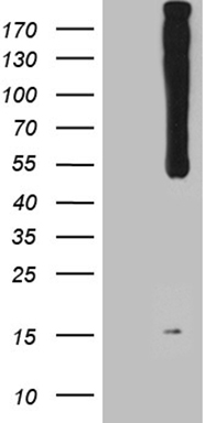 HEK293T cells were transfected with the pCMV6-ENTRY control (Left lane) or pCMV6-ENTRY WIPI1 (Right lane) cDNA for 48 hrs and lysed
