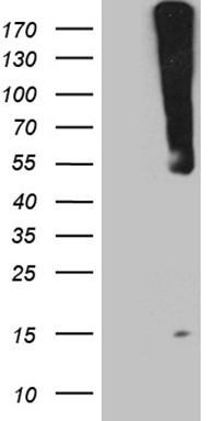HEK293T cells were transfected with the pCMV6-ENTRY control (Left lane) or pCMV6-ENTRY WIPI1 (Right lane) cDNA for 48 hrs and lysed