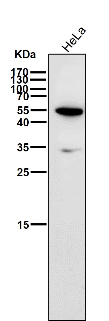 All lanes use the Antibody at 1:2K dilution for 1 hour at room temperature