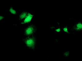m06211 anti sec14 like protein 2 sec14l2 mouse monoclonal antibody clone id oti4h2 if testing 7