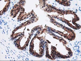 m06211 anti sec14 like protein 2 sec14l2 mouse monoclonal antibody clone id oti4h2 ihc testing 4
