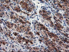 m06211 anti sec14 like protein 2 sec14l2 mouse monoclonal antibody clone id oti4h2 ihc testing 5