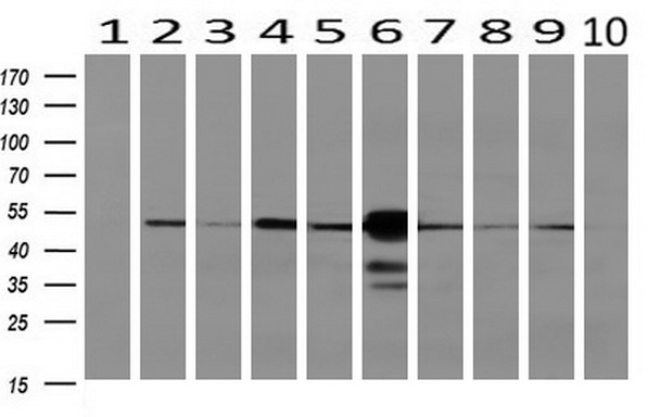 m06211 anti sec14 like protein 2 sec14l2 mouse monoclonal antibody clone id oti4h2 wb testing 2