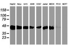 m06211 anti sec14 like protein 2 sec14l2 mouse monoclonal antibody clone id oti4h2 wb testing 3