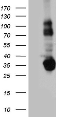 HEK293T cells were transfected with the pCMV6-ENTRY control (Left lane) or pCMV6-ENTRY STX3 (Right lane) cDNA for 48 hrs and lysed