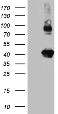 HEK293T cells were transfected with the pCMV6-ENTRY control (Left lane) or pCMV6-ENTRY STX3 (Right lane) cDNA for 48 hrs and lysed