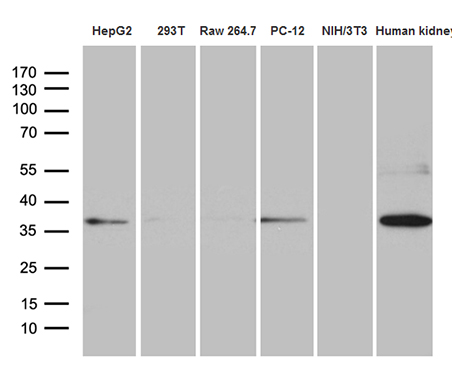 Western blot analysis of extracts (35ug) from 5 different cell lines and human kidney tissue lysate by using anti-STX3 monoclonal antibody (1:500)