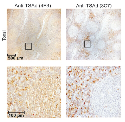 m06232 1 anti sh2d2a mouse monoclonal antibody clone id oti3c7 ihc testing 4