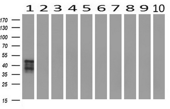 m06232 1 anti sh2d2a mouse monoclonal antibody clone id oti3c7 wb testing 2