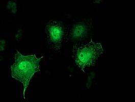m06232 anti sh2d2a mouse monoclonal antibody clone id oti4f3 if testing 12