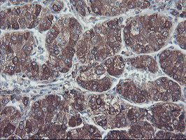 m06232 anti sh2d2a mouse monoclonal antibody clone id oti4f3 ihc testing 10