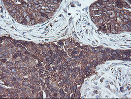 m06232 anti sh2d2a mouse monoclonal antibody clone id oti4f3 ihc testing 2