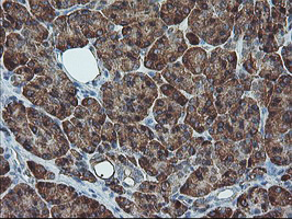 m06232 anti sh2d2a mouse monoclonal antibody clone id oti4f3 ihc testing 3