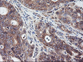 m06232 anti sh2d2a mouse monoclonal antibody clone id oti4f3 ihc testing 4