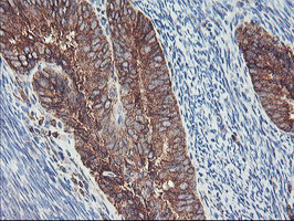 m06232 anti sh2d2a mouse monoclonal antibody clone id oti4f3 ihc testing 5