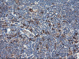 m06232 anti sh2d2a mouse monoclonal antibody clone id oti4f3 ihc testing 7