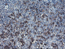 m06232 anti sh2d2a mouse monoclonal antibody clone id oti4f3 ihc testing 8