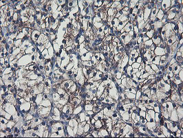 m06232 anti sh2d2a mouse monoclonal antibody clone id oti4f3 ihc testing 9