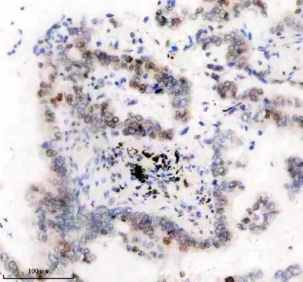 m06243 histone h1 2 primary antibodies ihc testing 1