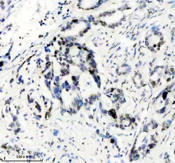 m06243 histone h1 2 primary antibodies ihc testing 2
