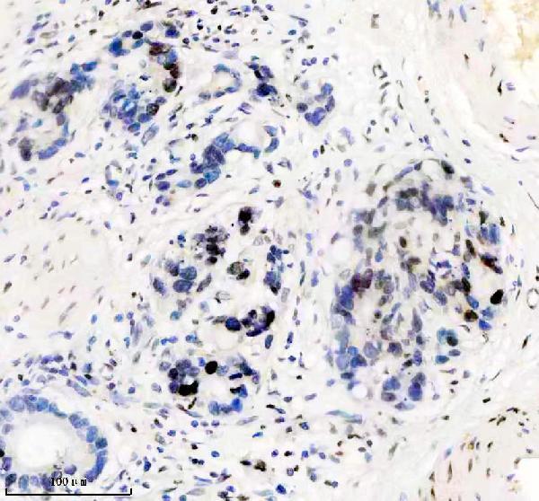 m06243 histone h1 2 primary antibodies ihc testing 3