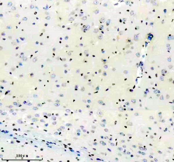 m06243 histone h1 2 primary antibodies ihc testing 5