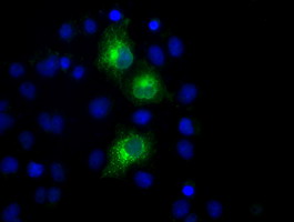 m06247 anti pkmyt1 mouse monoclonal antibody clone id oti5e1 if testing 14