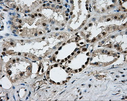 m06247 anti pkmyt1 mouse monoclonal antibody clone id oti5e1 ihc testing 10