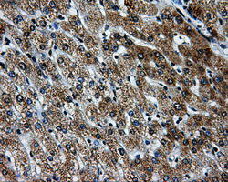 m06247 anti pkmyt1 mouse monoclonal antibody clone id oti5e1 ihc testing 11