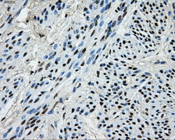 m06247 anti pkmyt1 mouse monoclonal antibody clone id oti5e1 ihc testing 4
