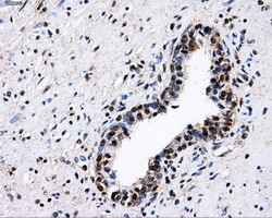 m06247 anti pkmyt1 mouse monoclonal antibody clone id oti5e1 ihc testing 5
