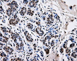 m06247 anti pkmyt1 mouse monoclonal antibody clone id oti5e1 ihc testing 6