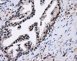 m06247 anti pkmyt1 mouse monoclonal antibody clone id oti5e1 ihc testing 7