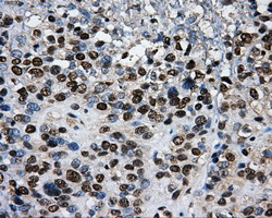 m06247 anti pkmyt1 mouse monoclonal antibody clone id oti5e1 ihc testing 8