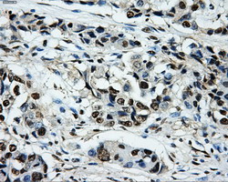 m06247 anti pkmyt1 mouse monoclonal antibody clone id oti5e1 ihc testing 9