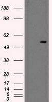 HEK293T cells were transfected with the pCMV6-ENTRY control (Left lane) or pCMV6-ENTRY PKMYT1 (Right lane) cDNA for 48 hrs and lysed