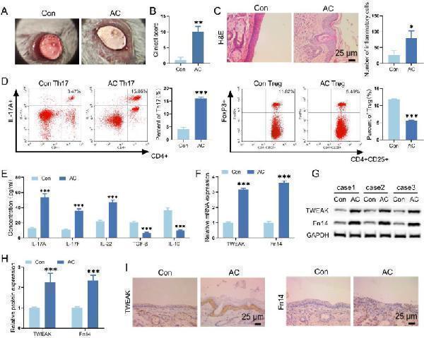 Th17/Treg cell differentiation ratio and TWEAK/Fn14 signaling level in AC mice