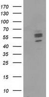 HEK293T cells were transfected with the pCMV6-ENTRY control (Left lane) or pCMV6-ENTRY CNDP1 (Right lane) cDNA for 48 hrs and lysed
